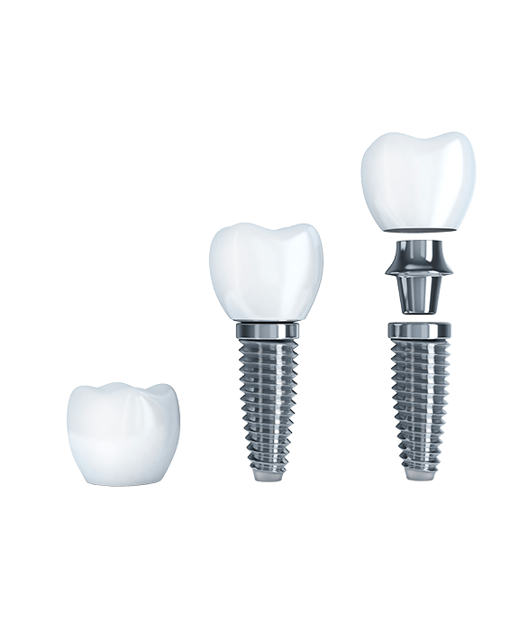 2.7.3_Dental_Abutments-and-Screws